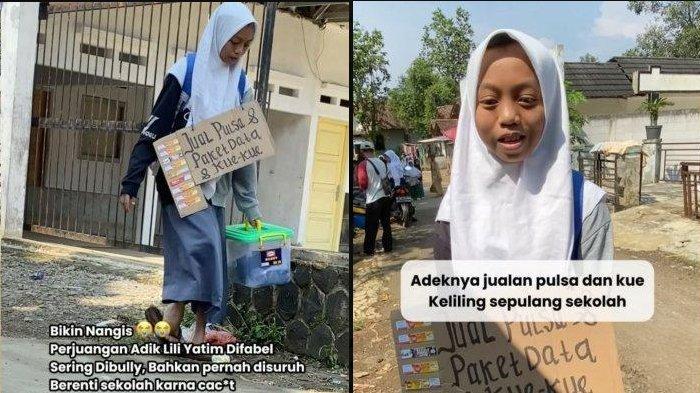 SOSOK Lili Siswi SMA Difabel Jualan Kue Untuk Hidupi Keluarga, Diejek Hingga Disuruh Putus Sekolah