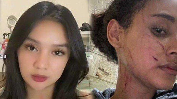 SOSOK Regi Nazlah Diduga Aniaya Afifah Riyadh, Dituding Tukang Bully Sejak SMP, Sempat Curhat Begini