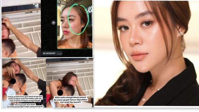 Nasib pilu dialami selebgram Lampung Anastasia Noor Widiastuti yang mengalami kekerasan dalam rumah tangga (KDRT) oleh mantan suaminya, Aditya Prayogi. (Ig)