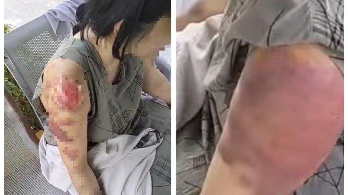 Sosok Nurlela Disekap dan Disiksa di Arab Saudi: Badan Disetrika, Dipukuli, Ditendang, Payudara Disiram. (Istimewa)