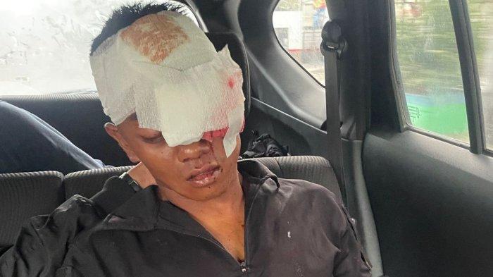 Tampang Prada Defliadi, personel Kodam I Bukit Barisan dari Batalyon Infanteri 100/Raider digebuki hingga babak belur dan dirawat di rumah sakit.