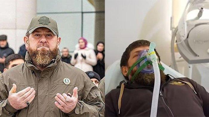Tangan kanan Presiden Rusia Vladimir Putin yang bernama Ramzan Kadyrov mengalami koma.