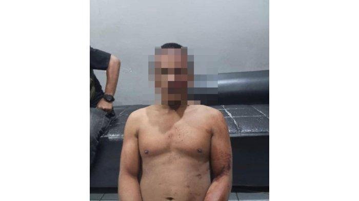 Toni Chandra alias Toni Codet, pelaku pencurian sepeda motor milik pedagang UMKM pancake durian di Kecamatan Delitua. Dia nyaris tewas digebuki massa, Rabu (11/10/2023).