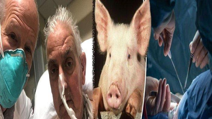 Transplantasi Jantung Babi ke Pasien Manusia