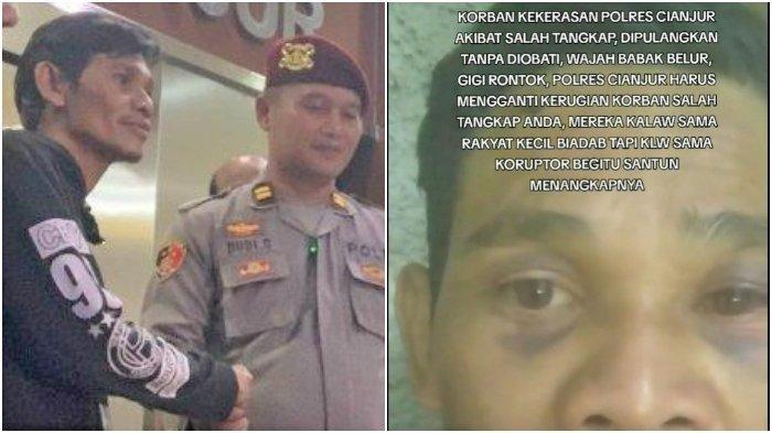 KORBAN SALAH TANGKAP: Ujang Suherli dikira sebagai pelaku kejahatan, babak belur dihajar. Polisi salah target

Ternyata polisi salah target.