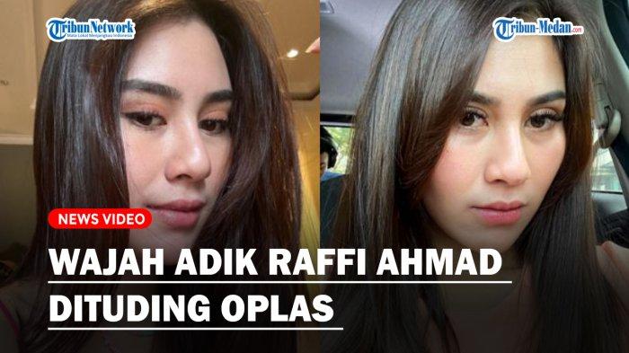 Wajah Adik Raffi Ahmad Dituding Oplas, Disebut Netizen Tampak Beda dan ...