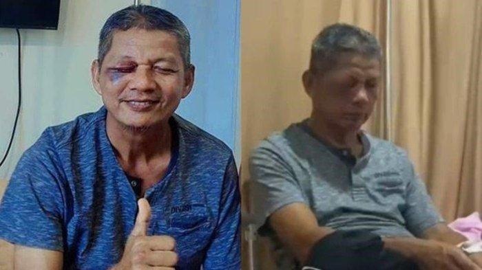 Zaharman (58) telah ikhlas kehilangan satu bola matanya karena diketapel orangtua murid.