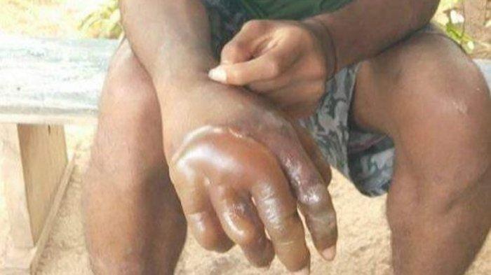 Aksi guru mencelupkan tangan siswanya ke air mendidih menjadi perhatian warganet. 