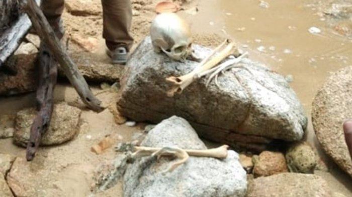 Ilustrasi Kerangka Manusia