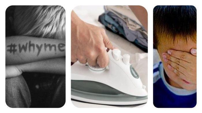 Kolase foto ilustrasi anak korban penganiayaan dan setrika. Kasus KDRT terjadi di Bungo Jambi, seorang ibu tega setrika lengan dan kaki kanan kiri anak tirinya hingga kulitnya melepuh hanya karena masalah uang Rp 8 juta.