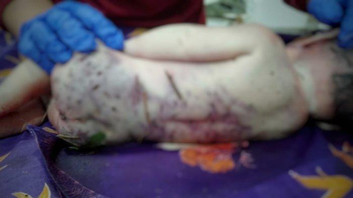 kondisi bayi yang ditemukan dalam keadaan sekarat