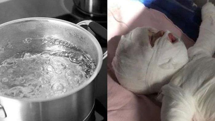 Kronologi Bayi Jatuh ke Ember Air Mendidih, Tangis Bayi Memilukan, Ini Pengakuan Sang Ibu