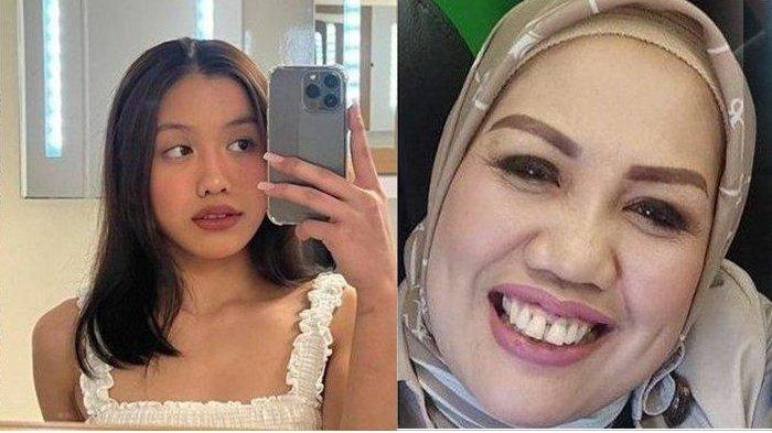 Lolly dan Elly Sugigi -