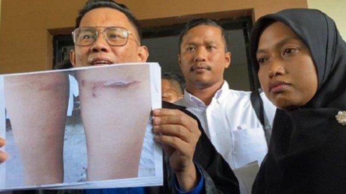 Kuasa hukum Supriyani, Andri Darmawan menunjukkan bukti luka di kaki anak Aipda WH terkait kasus dugaan penganiayaan di Konawe Selatan (Konsel), Sulawesi Tenggara (Sultra) - Dalam sidang lanjutan yang digelar di PN Andoolo, Kamis (7/11/2024), dokter forensik menegaskan penyebab luka anak Aipda WH bukan karena sapu, seperti yang dituduhkan kepada guru Supriyani. (TribunnewsSultra.com/Dewi Lestari)