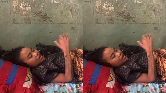 PENGAKUAN MENGEJUTKAN RATIH - Seorang ibu bernama Ratih Raynada (30) diduga menjadi korban malpraktik saat menjalani operasi caesar anak keempat di RSUD dr Chasbullah Abdulmadjid, Kota Bekasi, pada September 2024.