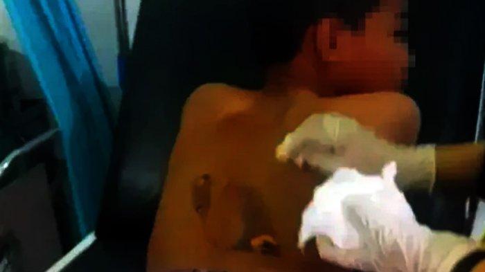 SEORANG santri berusia 13 tahun diduga disetrika gurunya karena tidak mengerjakan PR di salah satu pondok tahfiz di Kota Parepare (istimewa)