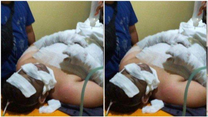 Kondisi Yusuf sekujur tubuhnya diperban usai kena ledakan septic tank