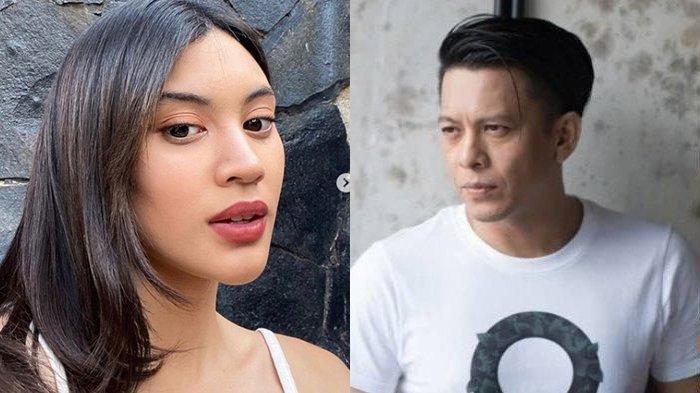 Siapa Naura Hakim? Cewek yang Fotonya Dipajang di IG Ariel NOAH, Dulu