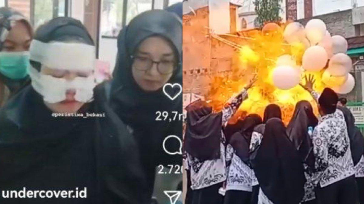 Balos gas meledak saat peringatan Hari Guru Nasional di SDN Cimuning 1 Bekasi, Sabru (25/11/2023). Akibatnya 10 guru alami luka bakar di wajah. 2 diantaranya luka berat.