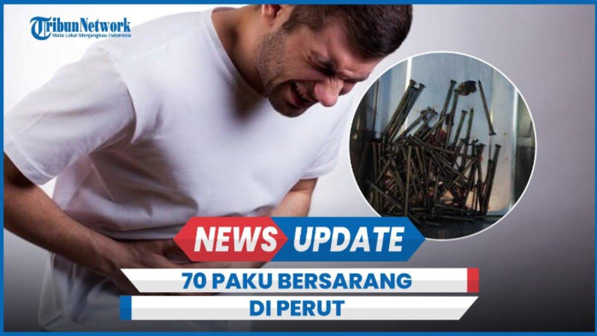 5 fakta mencengangkan kasus 70 paku yang bersarang di perut seorang pemuda di Indramayu, Jawa Barat yang diduga ODGJ & overdosis obat.
