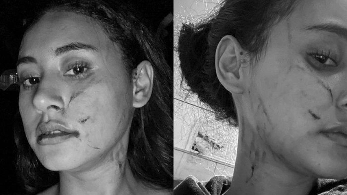 Afifah Riyad korban penyerangan mantan pacar suami