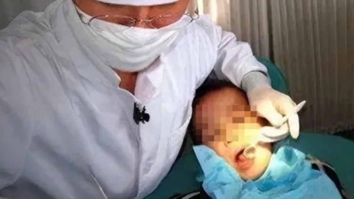 Anak memiliki penyakit di dalam mulutnya