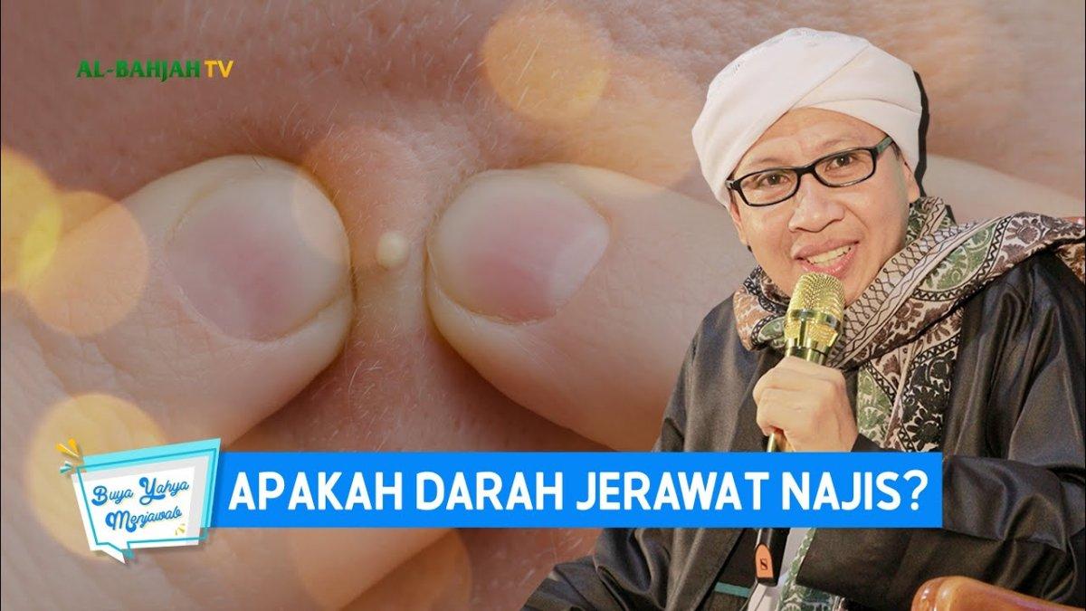 Apakah darah dari jerawat itu juga termasuk najis? Begini penjelasan dari Buya Yahya.