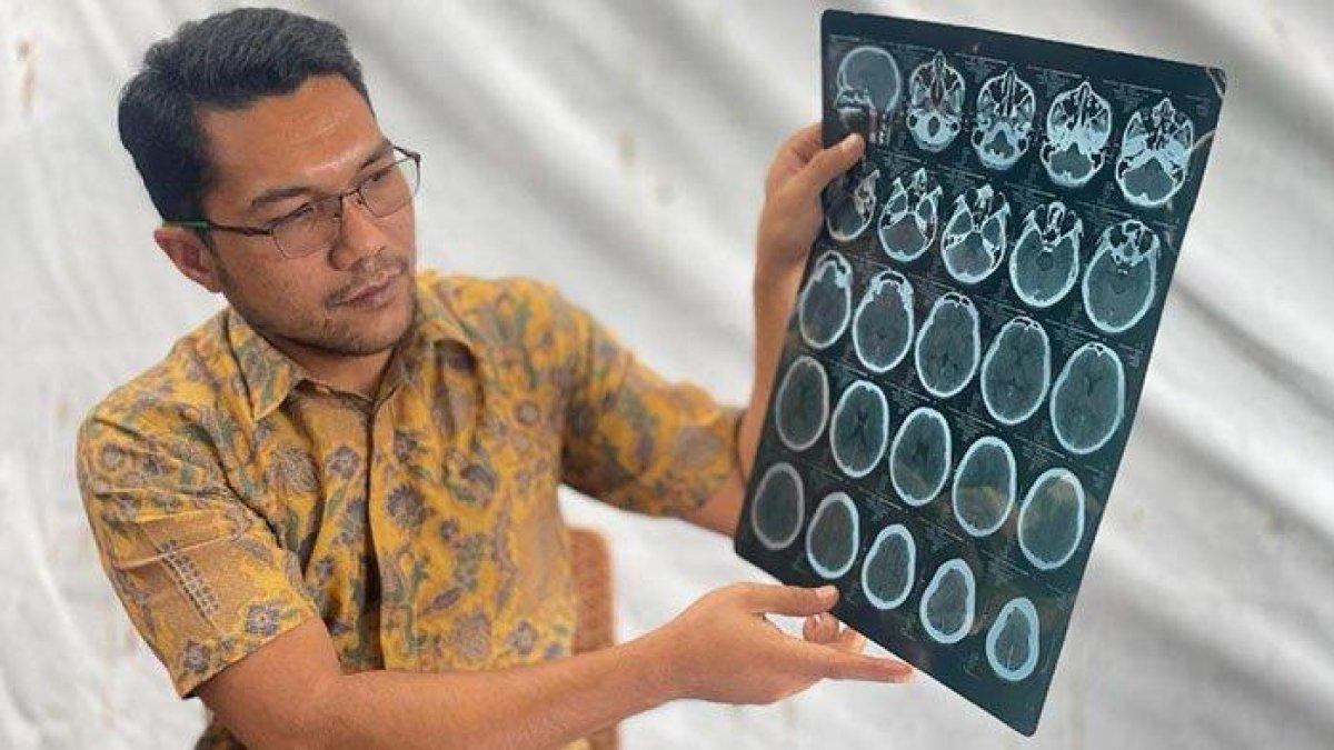 Ayah dari siswa SMA yang menjadi korban pengeroyokan dan aksi bullying memperlihatkan hasil rontgen bagian kepala anaknya, saat menyampaikan keterangan pers di Sekretariat Bersama (Sekber) Wartawan di Banda Aceh, Kamis (31/8/2023).