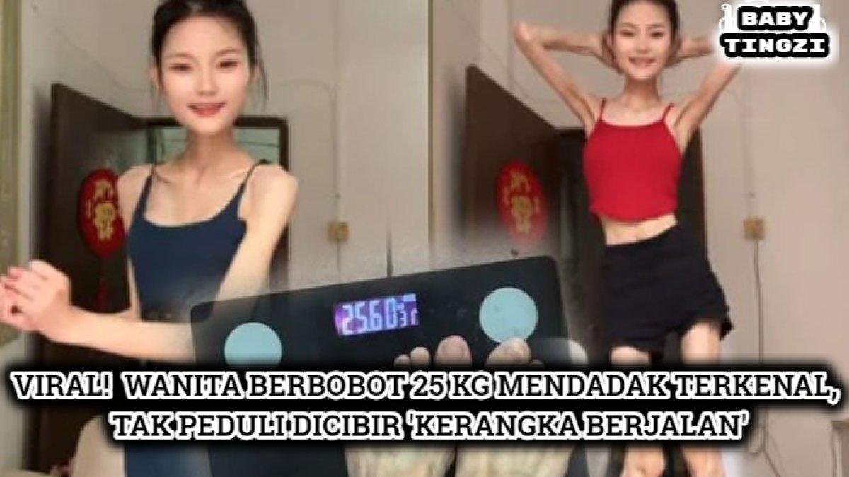 Sosok Baby Tingzi influencer asal China dengan berat badan 25 kg, sering disebut kerangka berjalan.