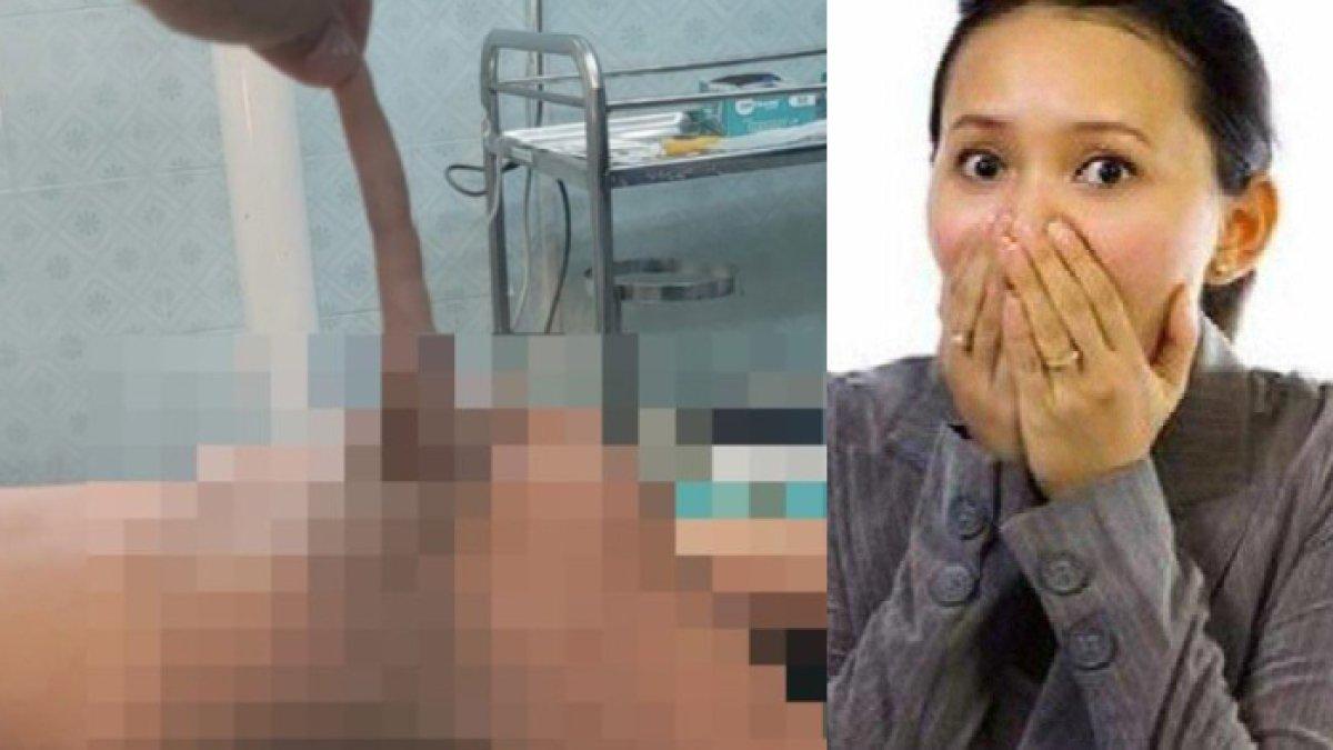 Bayi mendadak memiliki ekor 14cm, orangtua panik, kelainan langka