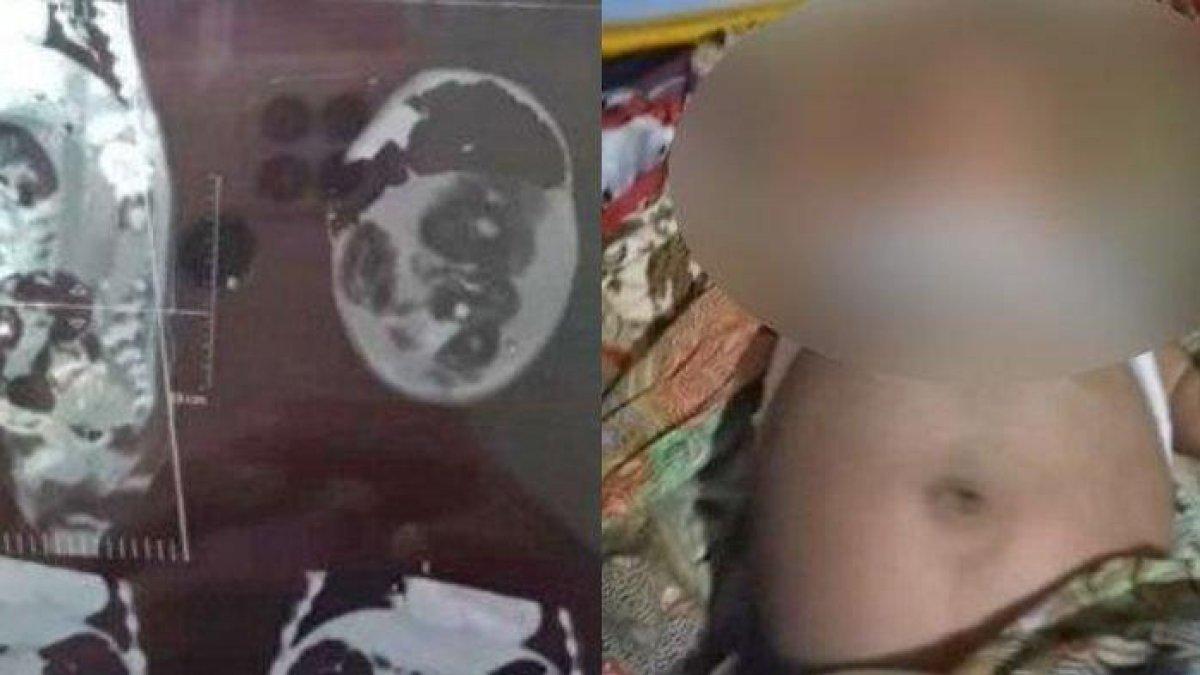 Bayi usia lima bulan hamil