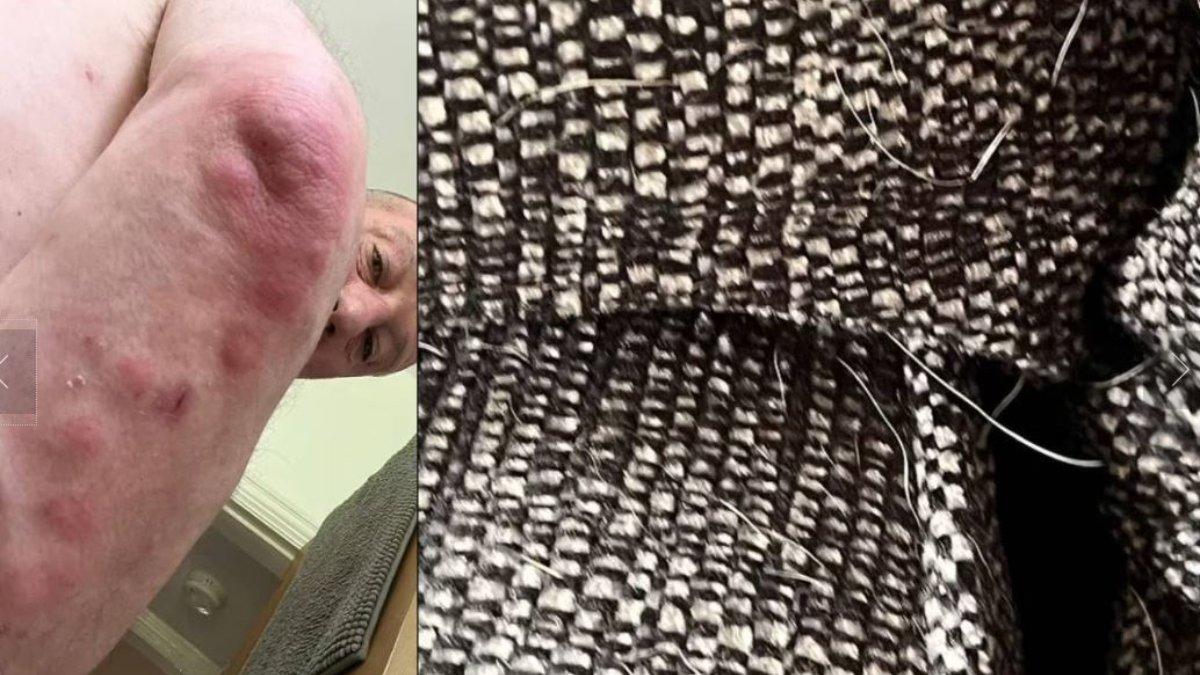 Beli sofa murah, pria alami gatal-gatal parah. s