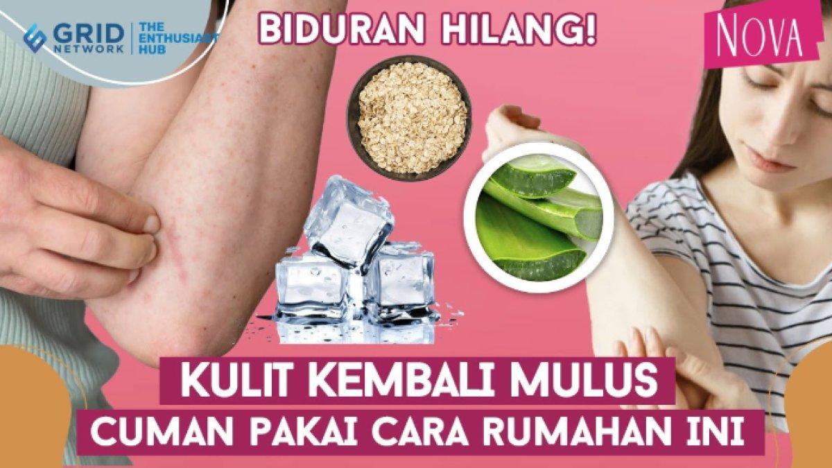 Cara alami atasi biduran