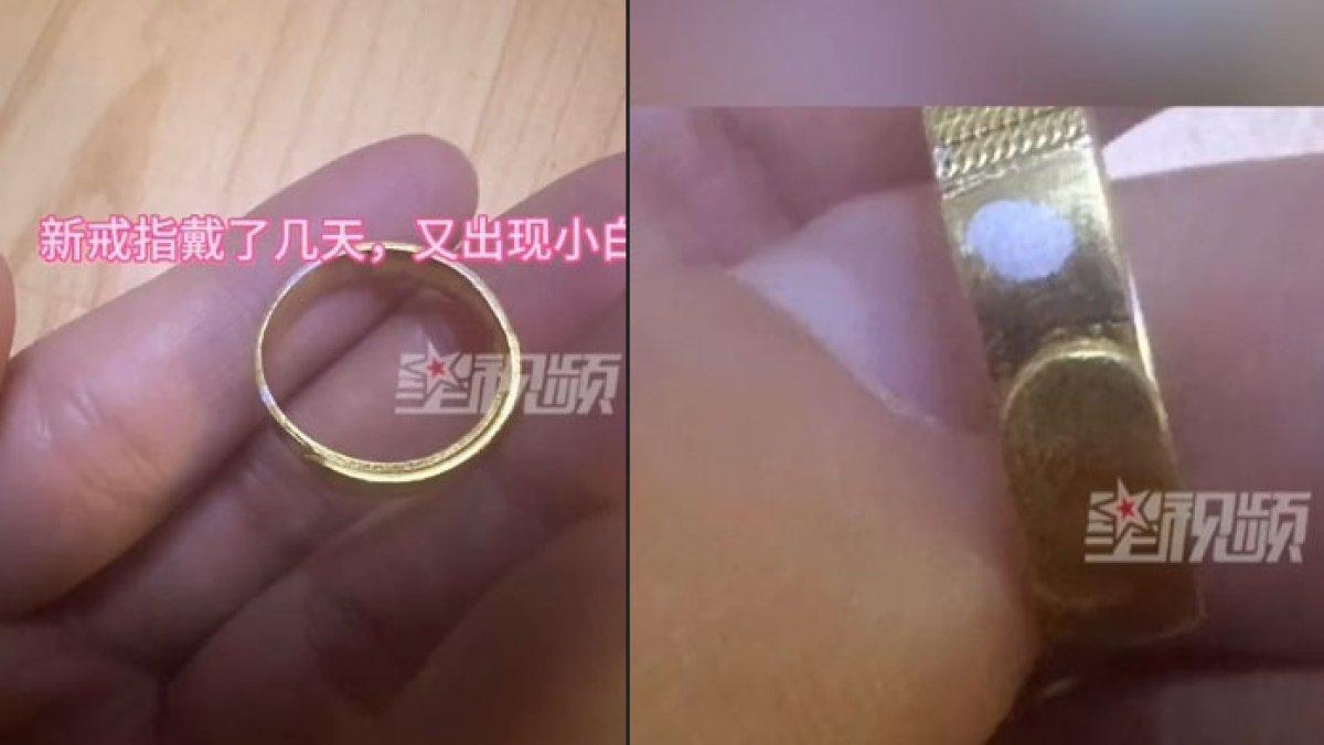 Cincin wanita ini selamatkan nyawa