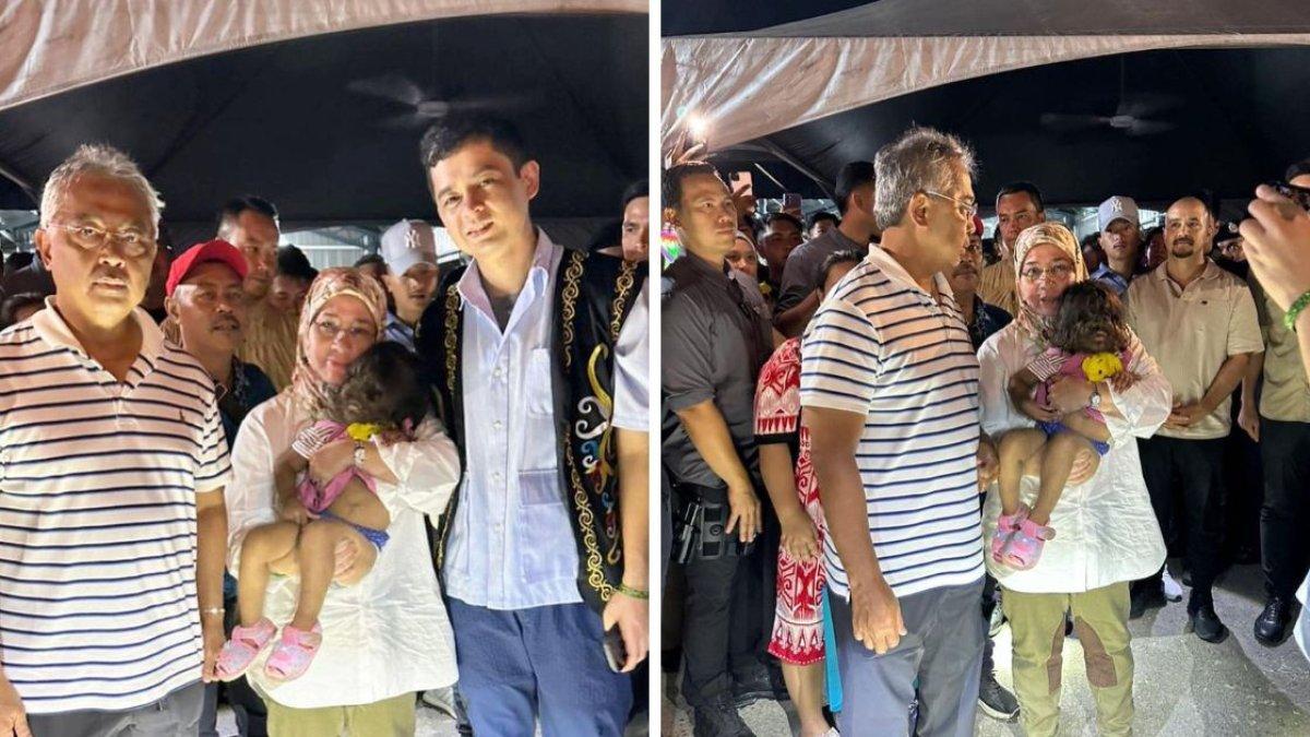 DERITA hipertrikosis, bocah ini dijuluki 'manusia serigala', kini orang tua bangga bisa bertemu Raja dan Permaisuri Malaysia