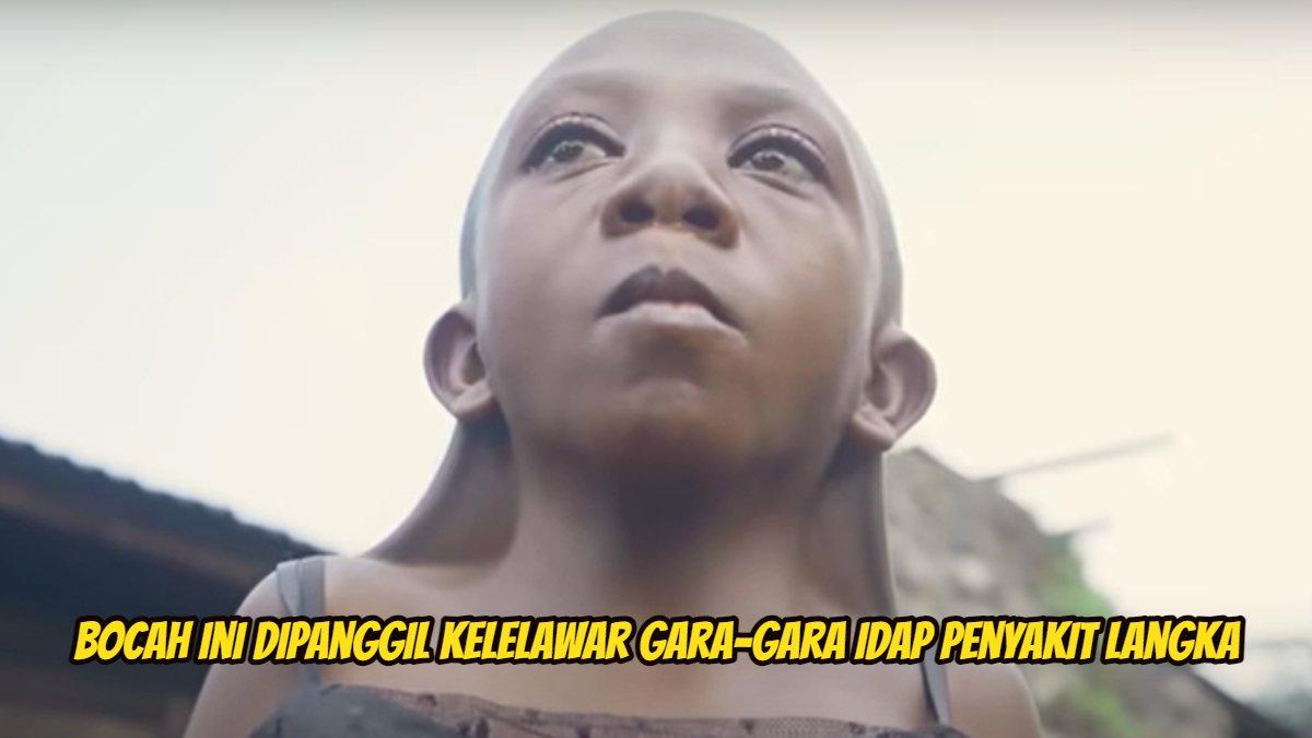 Diella seorang gadis berusia 9 tahun dari Republik Demokratik Kongo
