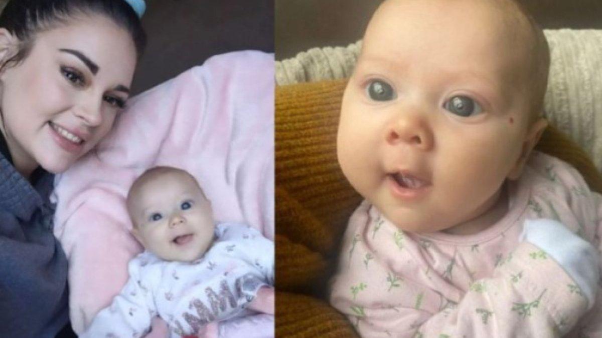 Dikira bayi lahir dengan mata yang indah, ternyata memiliki penyakit yang langka