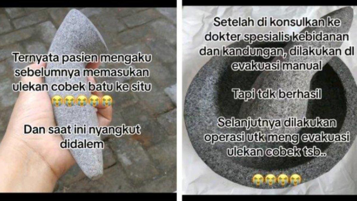 Dokter syok ada cobek nyangkut di alat vital pasien