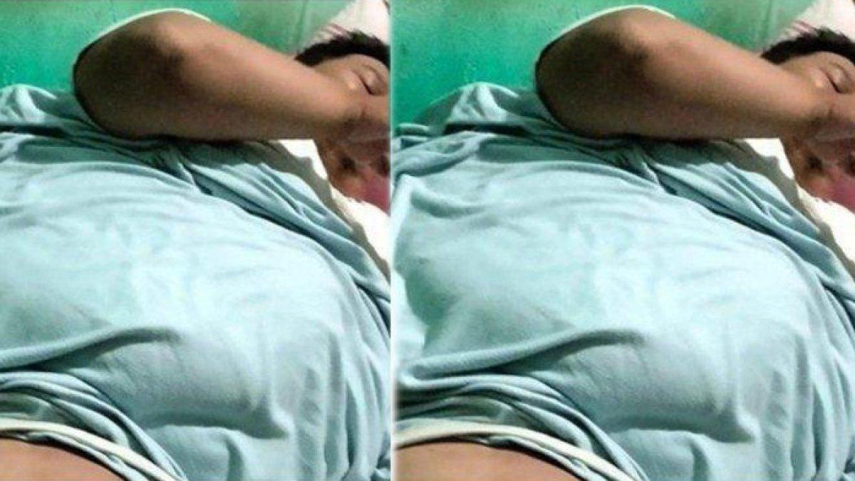 Engky, tukang ojek di Tangerang alami obesitas 200 kg, kaki bengkak sebelah