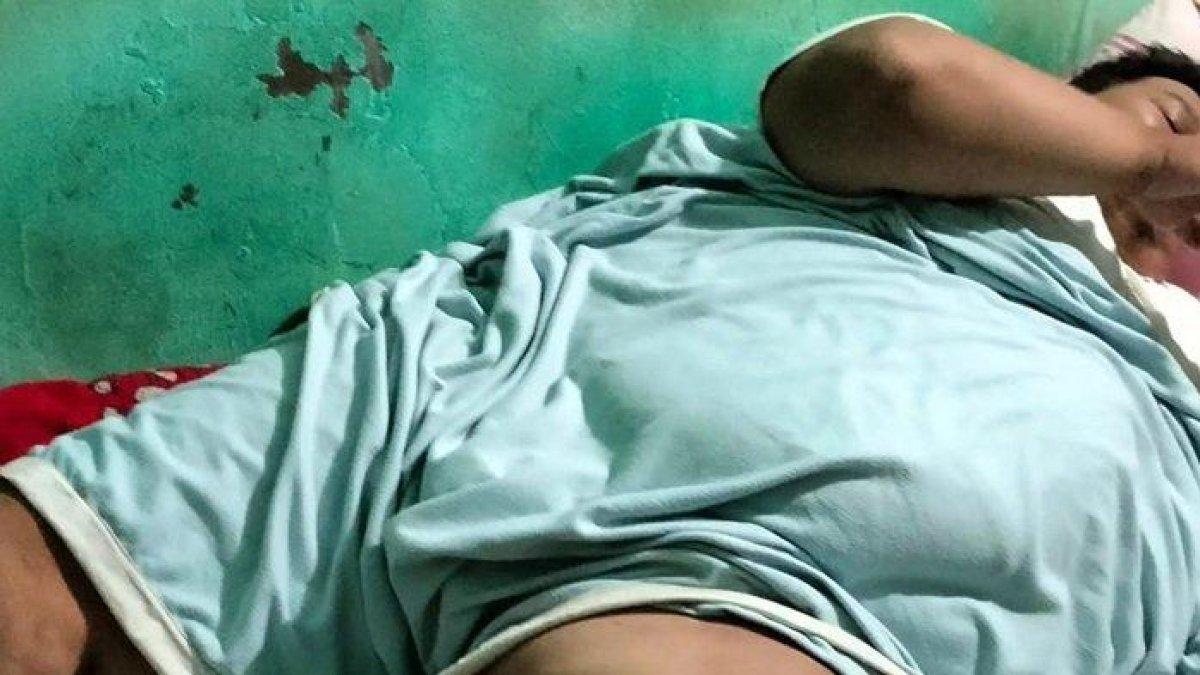 Engky, tukang ojek di Tangerang alami obesitas 200 kg, kaki bengkak sebelah