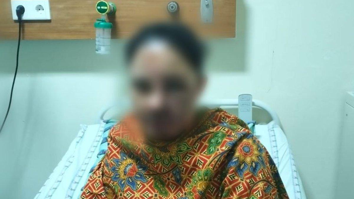 Fika (28) korban penyiraman air keras yang dilakukan oleh mantan suaminya masih terbaring lemah di ruang perawatan luka bakar lantai 2 RDUP Wahidin Sudirohusodo Makassar, Sulsel, Rabu (21/2/2024)