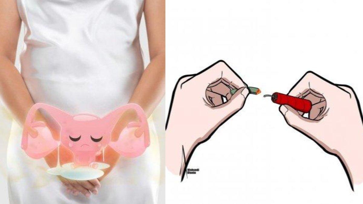 ILUSTRASI pria masukkan petasan ke dalam vagina istrinya, meledak, kini pendarahan hebat