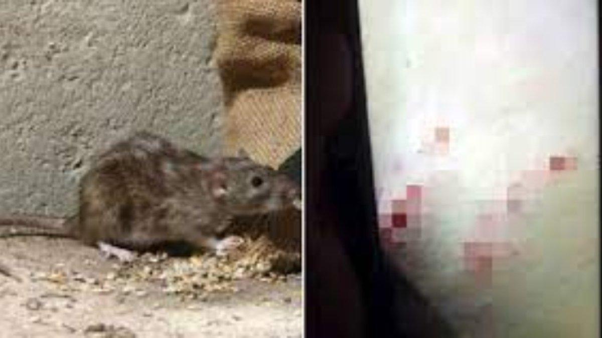 ILUSTRASI tikus mencakar kulit manusia