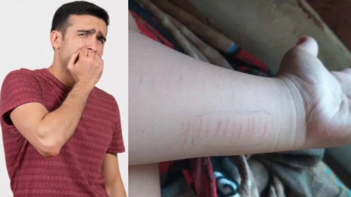 Ingin iku tren di TikTok, sebelas siswa di Situbondo nekat menyayat kulitnya dengan sajam, pemkab tindak tegas