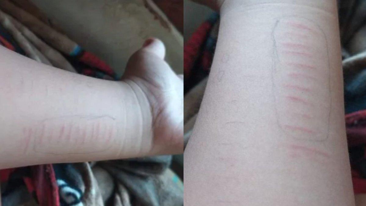 Ingin iku tren di TikTok, sebelas siswa di Situbondo nekat menyayat kulitnya dengan sajam, pemkab tindak tegas