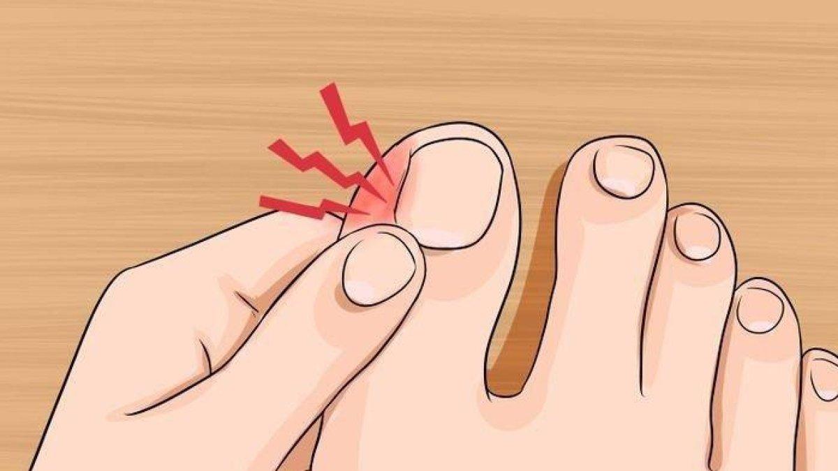 Inilah Tanda-tanda Asam Urat, Rasa Sakit pada Jempol Kaki