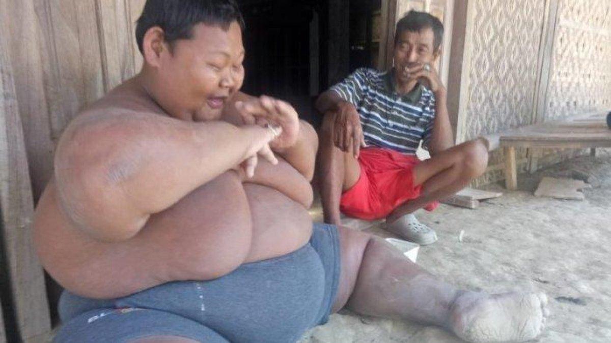 Inilah sosok Sungadi, pemuda obesitas 165 kg asal Sragen yang selalu kabur tiap dengar sirine ambulans