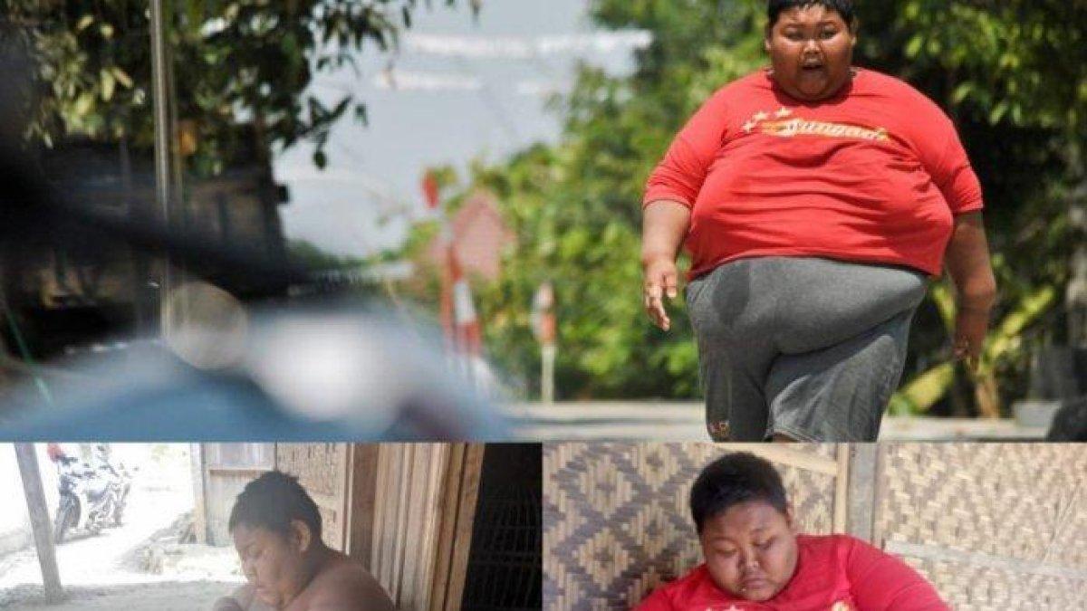 Inilah sosok Sungadi, pemuda obesitas 165 kg asal Sragen yang selalu kabur tiap dengar sirine ambulans