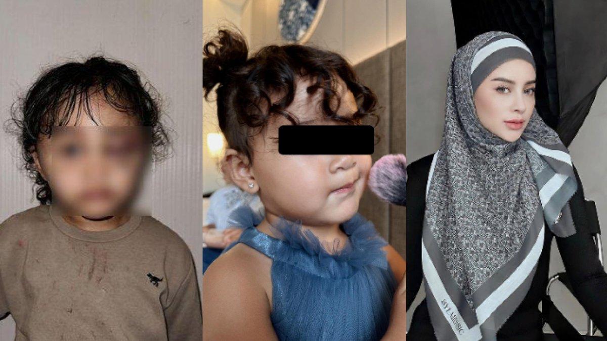 Jana Amira Priyanka, putri pertama dari selebgram Aghnia Punjabi diduga menjadi korban penganiayaan yang dilakukan pengasuhnya berinisial I. Kondisi fisik sang anak dan kejadian nahas tersebut diungkap oleh sang selebgram di laman Instagram pribadi miliknya.