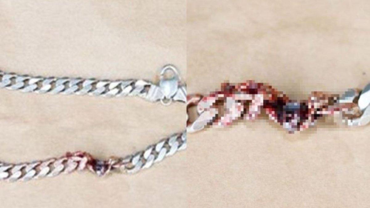 Kalung logam penyelamat